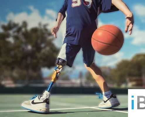 9 Year Old Boy Without a Leg But He Still Love Sport - Ezra Frech by Casino588